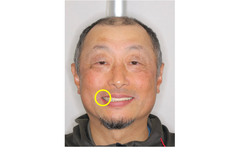 症例紹介
